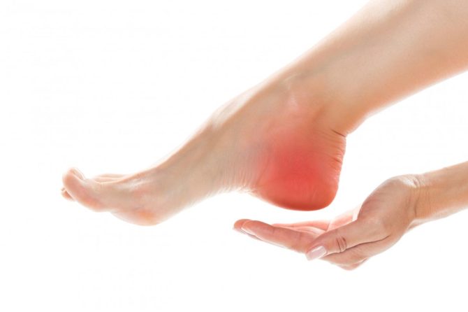 Petni trn – uzroci, simptomi, lečenje i vežbe