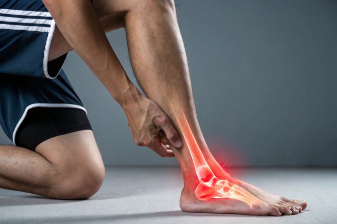 Tendinitis – zapaljenje tetiva i kako ga lečiti